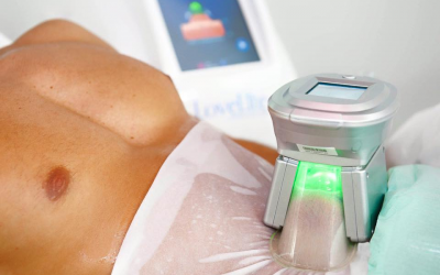 How the Cryolipolysis Machine Can Benefit You