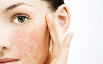 Как спасти нашу чувствительную кожу?